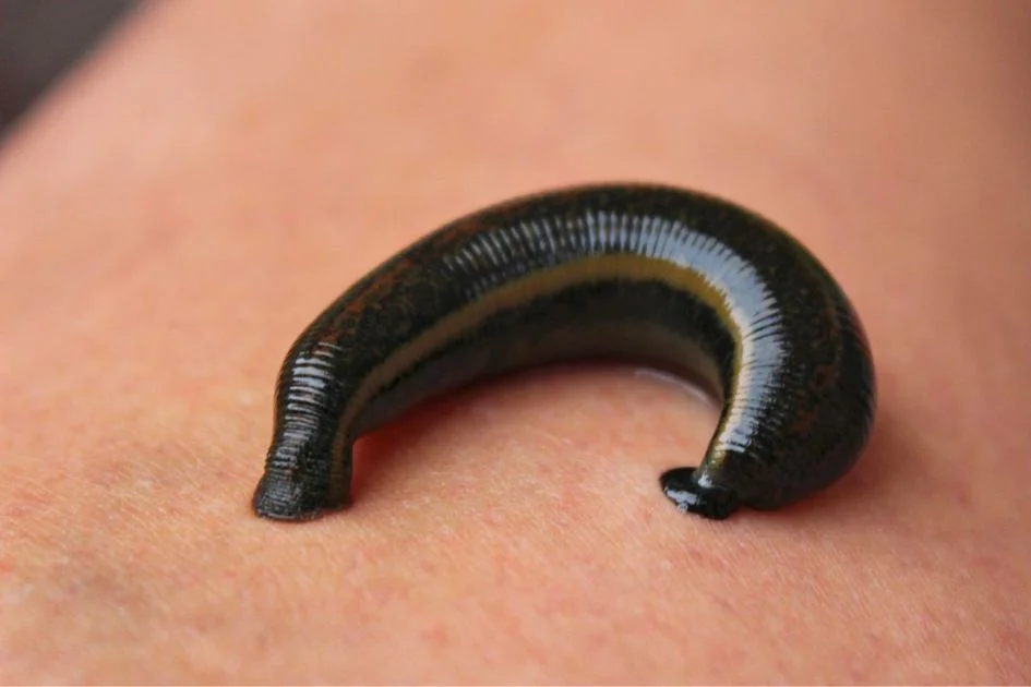 Leech (Hirudinea) Sucking on Human Skin