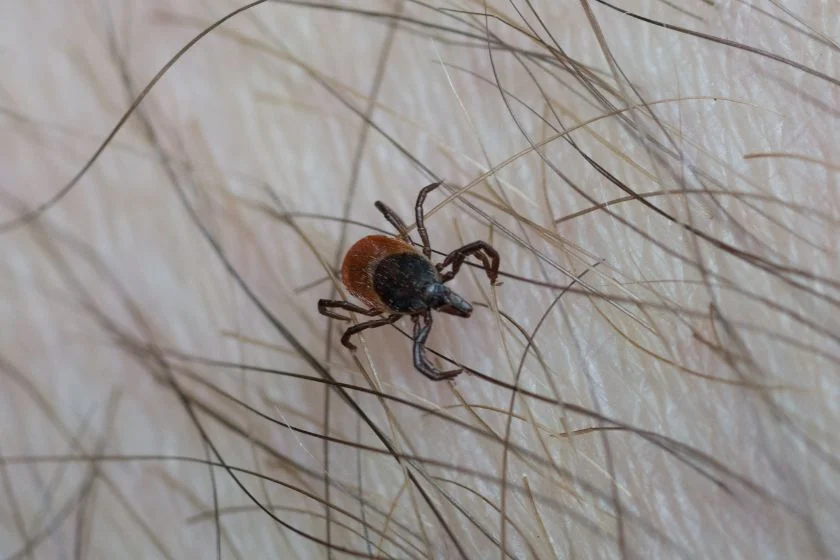 Close Up View of Black-legged (Ixodes scapularis) Ticks on Skin