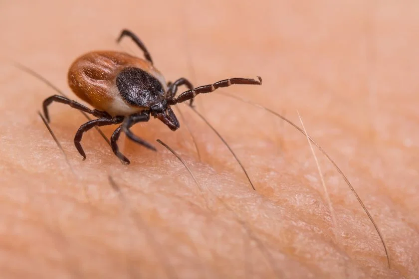 Deer Tick (Ixodes scapularis) Close Up on Human Skin