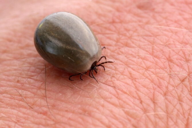 Close Up Hard-backed Tick on Human Skin